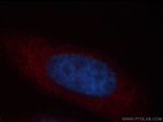 TARS Antibody in Immunocytochemistry (ICC/IF)