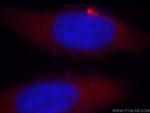 TARS Antibody in Immunocytochemistry (ICC/IF)