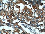 TARS Antibody in Immunohistochemistry (Paraffin) (IHC (P))