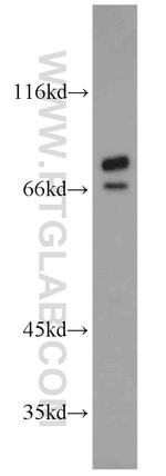 TARS Antibody in Western Blot (WB)