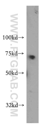 TARS Antibody in Western Blot (WB)