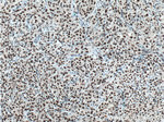 HNRNPH1 Antibody in Immunohistochemistry (Paraffin) (IHC (P))