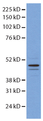 HNRNPH1 Antibody in Western Blot (WB)