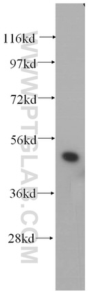 HNRNPH1 Antibody in Western Blot (WB)