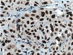 HNRNPH1 Antibody in Immunohistochemistry (Paraffin) (IHC (P))