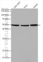 HNRNPH1 Antibody in Western Blot (WB)