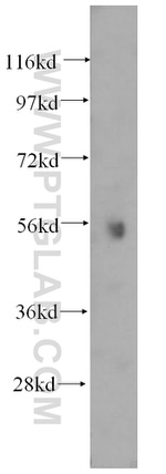 ATP6V1B1 Antibody in Western Blot (WB)