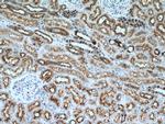 ATP6V1B1 Antibody in Immunohistochemistry (Paraffin) (IHC (P))