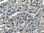 ERLIN2 Antibody in Immunohistochemistry (Paraffin) (IHC (P))