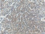 ERLIN2 Antibody in Immunohistochemistry (Paraffin) (IHC (P))