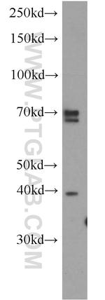 ERLIN2 Antibody in Western Blot (WB)