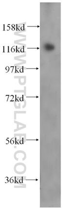 USP36 Antibody in Western Blot (WB)