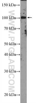 USP36 Antibody in Western Blot (WB)