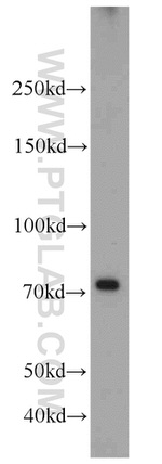 RFX3 Antibody in Western Blot (WB)