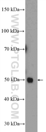 PSMD11 Antibody in Western Blot (WB)