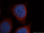 CBS Antibody in Immunocytochemistry (ICC/IF)