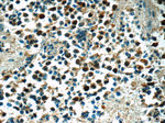 SNRPD2 Antibody in Immunohistochemistry (Paraffin) (IHC (P))