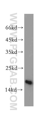 SNRPD2 Antibody in Western Blot (WB)