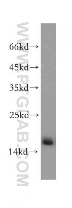 SNRPD2 Antibody in Western Blot (WB)