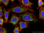 NDUFB8 Antibody in Immunocytochemistry (ICC/IF)