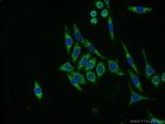 NDUFB8 Antibody in Immunocytochemistry (ICC/IF)