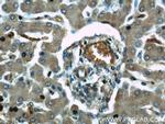 NDUFB8 Antibody in Immunohistochemistry (Paraffin) (IHC (P))