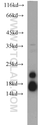 NDUFB8 Antibody in Western Blot (WB)