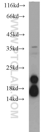 NDUFB8 Antibody in Western Blot (WB)