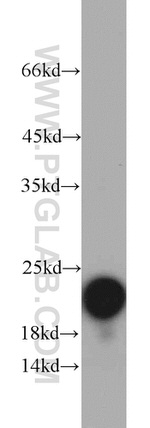 NDUFB8 Antibody in Western Blot (WB)
