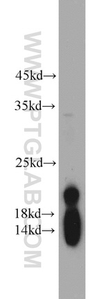 NDUFB8 Antibody in Western Blot (WB)