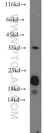 NDUFB8 Antibody in Western Blot (WB)