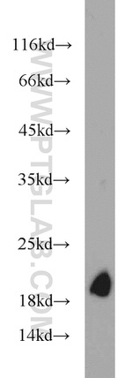 NDUFB8 Antibody in Western Blot (WB)