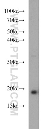 NDUFB8 Antibody in Western Blot (WB)