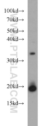 NDUFB8 Antibody in Western Blot (WB)