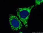 MRPL12 Antibody in Immunocytochemistry (ICC/IF)