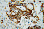 MRPL12 Antibody in Immunohistochemistry (Paraffin) (IHC (P))