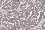 MRPL12 Antibody in Immunohistochemistry (Paraffin) (IHC (P))