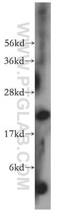 MRPL12 Antibody in Western Blot (WB)