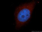 HMBS Antibody in Immunocytochemistry (ICC/IF)