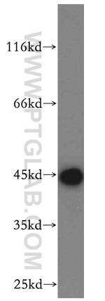 HMBS Antibody in Western Blot (WB)