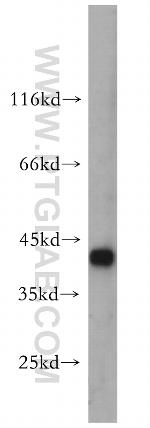 HMBS Antibody in Western Blot (WB)