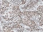 DDX39B Antibody in Immunohistochemistry (Paraffin) (IHC (P))