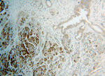 RPS4X Antibody in Immunohistochemistry (Paraffin) (IHC (P))