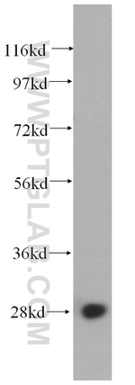 RPS4X Antibody in Western Blot (WB)