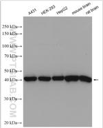 GOT2 Antibody in Western Blot (WB)