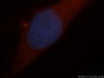 ARD1A Antibody in Immunocytochemistry (ICC/IF)