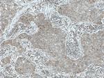 ARD1A Antibody in Immunohistochemistry (Paraffin) (IHC (P))