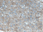 ARD1A Antibody in Immunohistochemistry (Paraffin) (IHC (P))