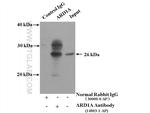 ARD1A Antibody in Immunoprecipitation (IP)