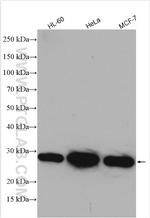 ARD1A Antibody in Western Blot (WB)